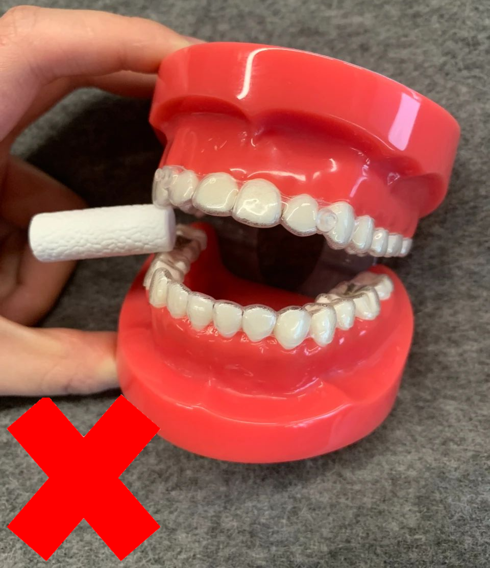 牙科材料硅胶怎么用隐形矫正中，咬胶如何正确使用_https://www.jmylbn.com_新闻资讯_第19张