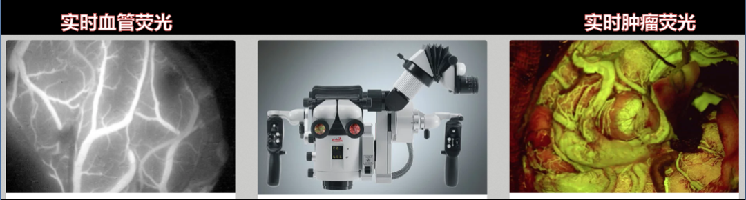 手术灯怎么打开灯关了，咋子做手术？_https://www.jmylbn.com_新闻资讯_第18张