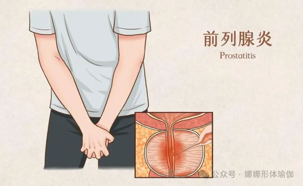 治疗慢性前列腺炎，要用抗生素而不是消炎药，你吃对了吗？