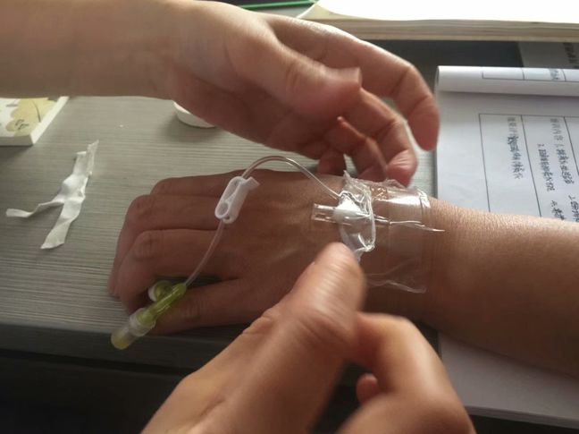留置针怎么贴膜留置针贴膜使用小技巧_https://www.jmylbn.com_新闻资讯_第3张