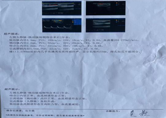 活检钳怎么用医技丨微创引领血管通路新时代，活检钳在自体动静脉内瘘血栓形成中的应用_https://www.jmylbn.com_新闻资讯_第6张