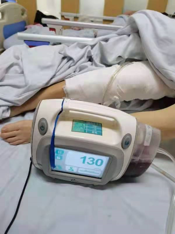 为什么负压引流再谈负压封闭引流技术_https://www.jmylbn.com_新闻资讯_第12张