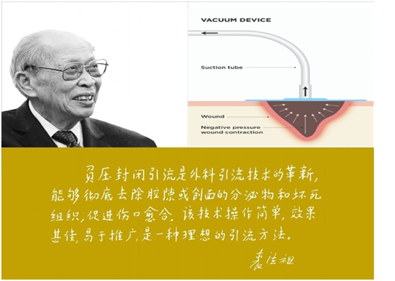 为什么负压引流再谈负压封闭引流技术_https://www.jmylbn.com_新闻资讯_第1张