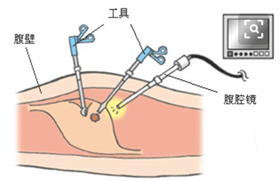 richardwolf什么品牌内窥镜行业分析_https://www.jmylbn.com_新闻资讯_第8张