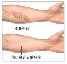 疤不得怎么用贴的，抹得，去疤药怎么选择怎么用？_https://www.jmylbn.com_新闻资讯_第2张