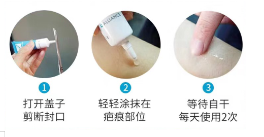 疤不得怎么用贴的，抹得，去疤药怎么选择怎么用？_https://www.jmylbn.com_新闻资讯_第4张