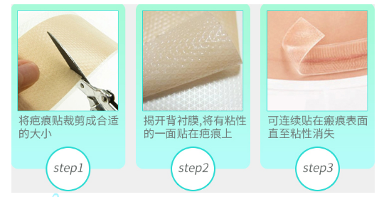 疤不得怎么用贴的，抹得，去疤药怎么选择怎么用？_https://www.jmylbn.com_新闻资讯_第3张