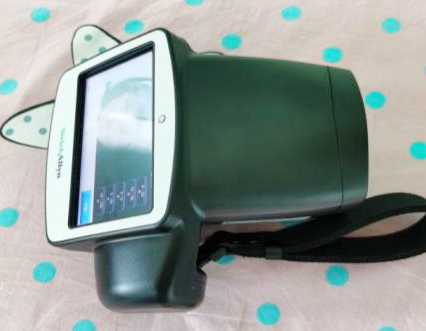 伟伦视力是什么2秒测宝宝视力，息县妇幼保健院儿童保健科引进美国最新款伟伦双目视力筛查仪_https://www.jmylbn.com_新闻资讯_第5张