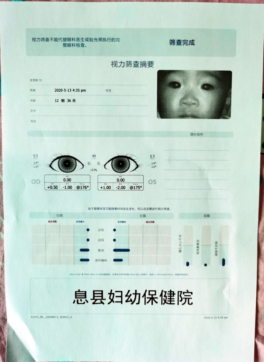 伟伦视力是什么2秒测宝宝视力，息县妇幼保健院儿童保健科引进美国最新款伟伦双目视力筛查仪_https://www.jmylbn.com_新闻资讯_第8张