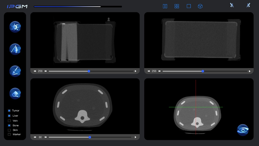 Qt助力横乐科技手术机器人研发与创新应用|Qt商业版客户的图4