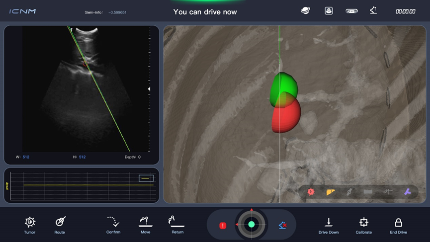 Qt助力横乐科技手术机器人研发与创新应用|Qt商业版客户的图2