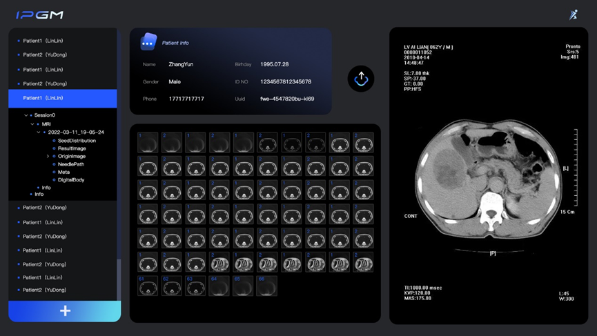 Qt助力横乐科技手术机器人研发与创新应用|Qt商业版客户的图3
