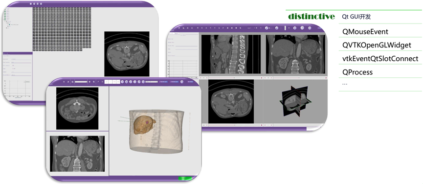 Qt医疗行业案例分享的图7