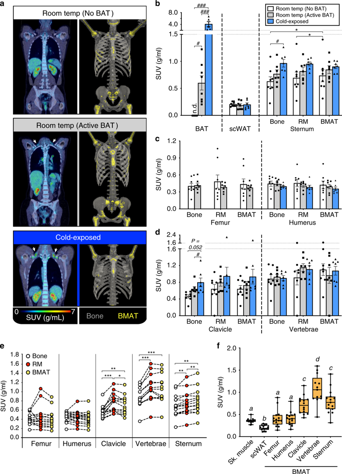 bm细胞是什么细胞Nature communications：骨髓脂肪组织是独特的脂肪亚型，在葡萄糖稳态中具有独特的作用_https://www.jmylbn.com_新闻资讯_第8张