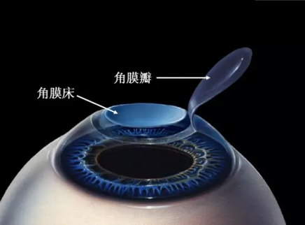 什么是飞秒？和激光有什么关系？