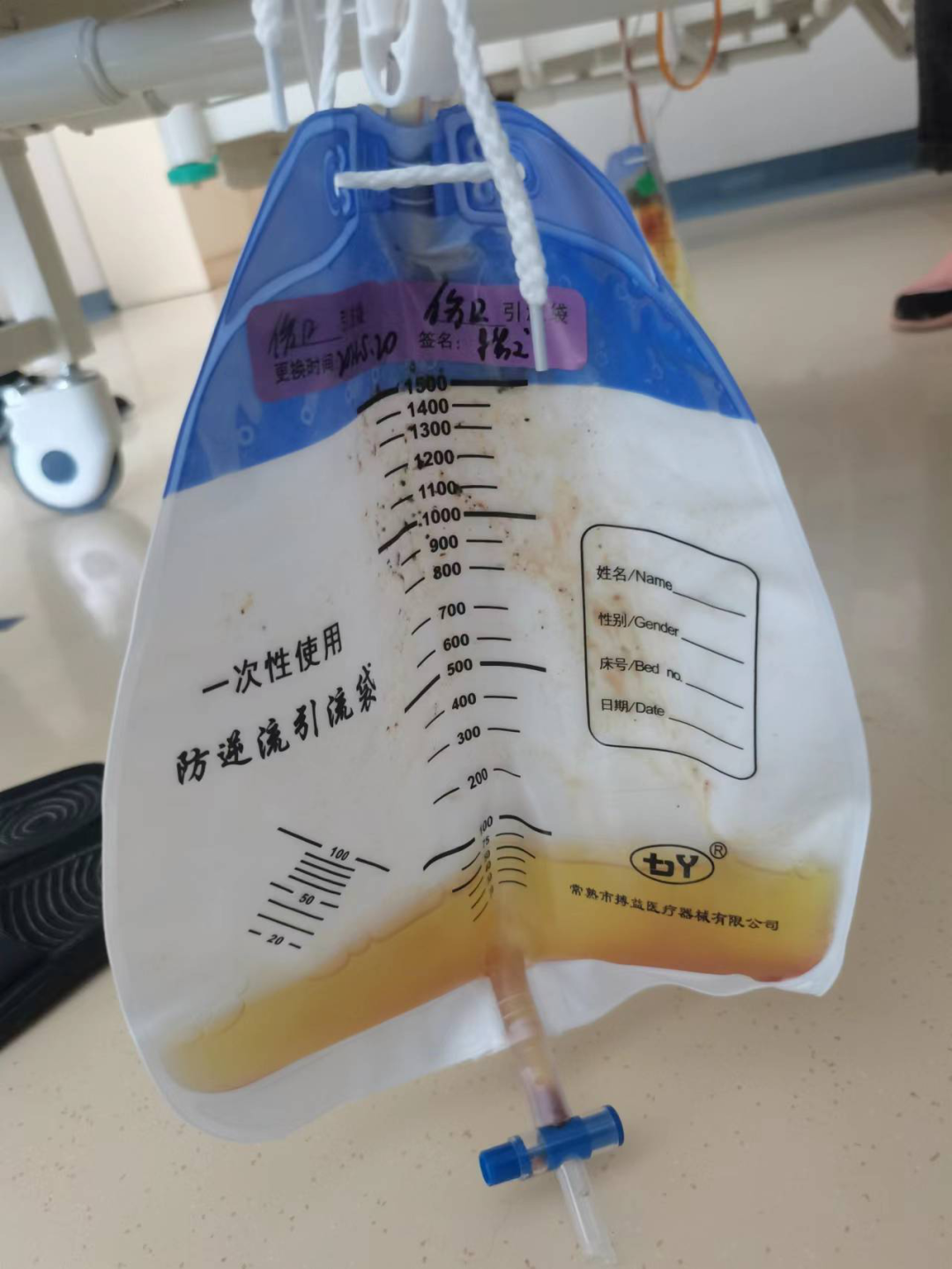 引流器排泄怎么用一根“管子”能解黄！｜ 经皮肝穿刺胆道引流术轻松解决胆汁排泄障碍_https://www.jmylbn.com_新闻资讯_第6张