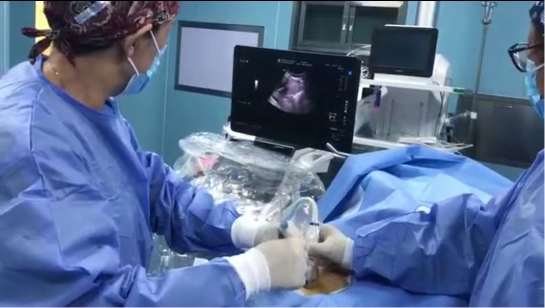 引流器排泄怎么用一根“管子”能解黄！｜ 经皮肝穿刺胆道引流术轻松解决胆汁排泄障碍_https://www.jmylbn.com_新闻资讯_第4张