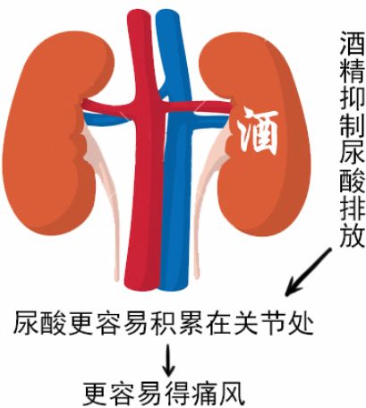 可怕，連90後都開始痛風了！沒那皇帝命，卻得了皇帝病 健康 第9張