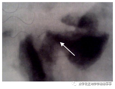 曲面断层片怎么看正畸【曲面断层片（全景片）】如何解读和查看：牙周？牙体？牙髓？关节？_https://www.jmylbn.com_新闻资讯_第30张