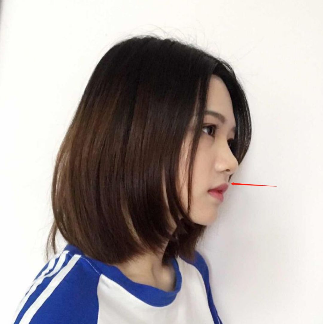 父母不同意矫正牙齿那就自己去挣钱