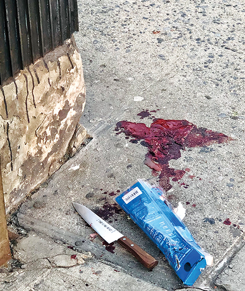 割脸、刺背，满地鲜血！华男布碌仑街头被捅伤，嫌犯也是华男，在逃...（组图） - 2