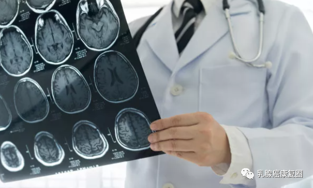 乳腺红外线检测什么乳腺癌影像学检查项目科普，正确理解检查和结果解读_https://www.jmylbn.com_新闻资讯_第5张