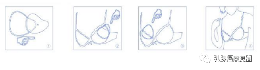 压力绷带为什么那么贵乳腺癌患者术后的压力胸衣 弹力绷带 弹力袖套 义乳相关科普_https://www.jmylbn.com_新闻资讯_第14张