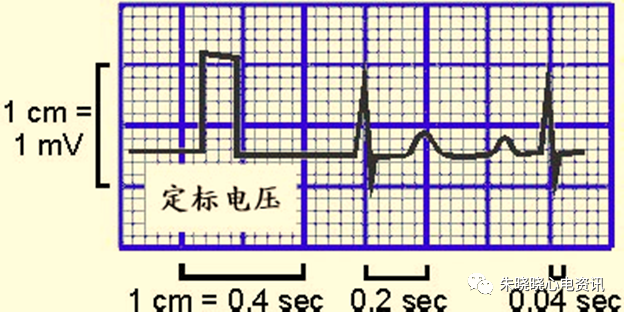 心电图纸的描述有哪些一文全解析 心电图到底该怎么看？_https://www.jmylbn.com_新闻资讯_第5张