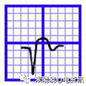 心电图纸的描述有哪些一文全解析 心电图到底该怎么看？_https://www.jmylbn.com_新闻资讯_第26张