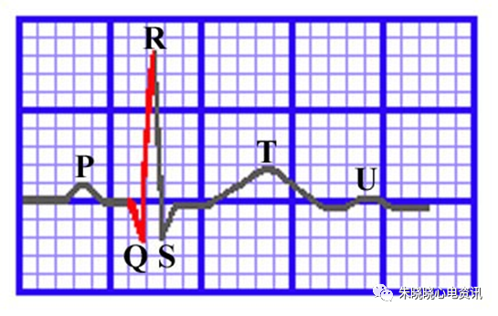 心电图纸的描述有哪些一文全解析 心电图到底该怎么看？_https://www.jmylbn.com_新闻资讯_第11张