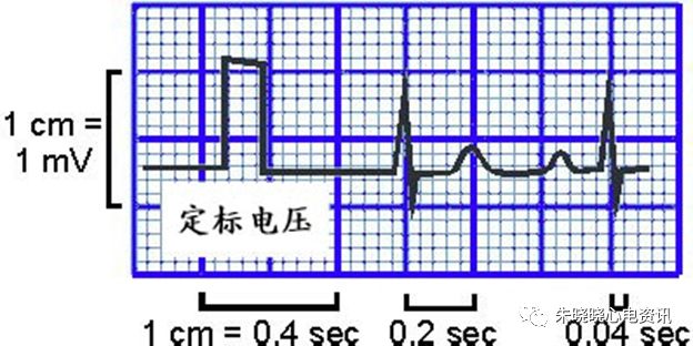 心电图纸怎么看【临床实用心电图入门】第三讲：心电图的测量要点_https://www.jmylbn.com_新闻资讯_第2张