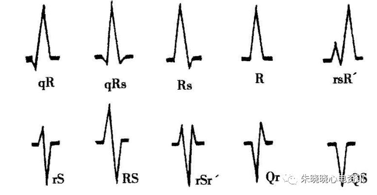 心电图怎么切换导联临床实用心电图入门系列之二：心电图导联、波形及临床价值_https://www.jmylbn.com_新闻资讯_第11张