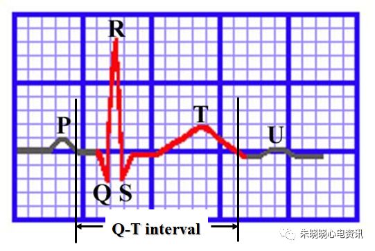 心电图纸怎么看【临床实用心电图入门】第三讲：心电图的测量要点_https://www.jmylbn.com_新闻资讯_第10张