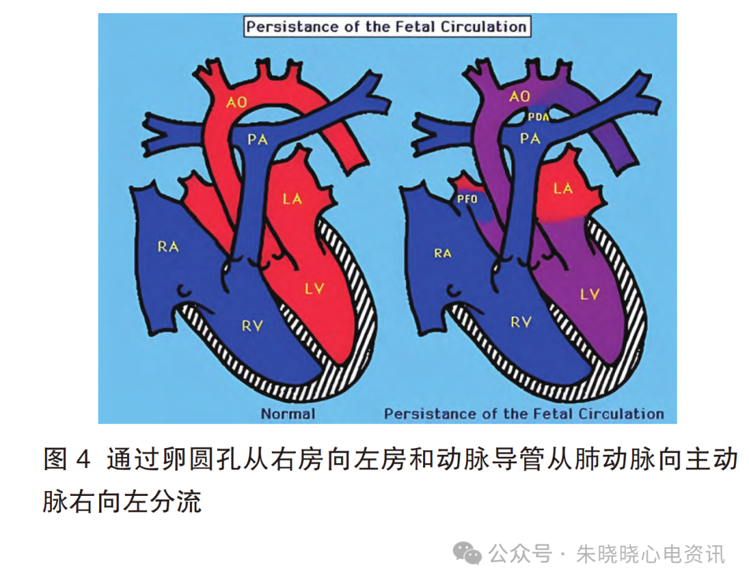 胎儿心电图是什么意思儿童心脏发育与心电图概述_https://www.jmylbn.com_新闻资讯_第7张