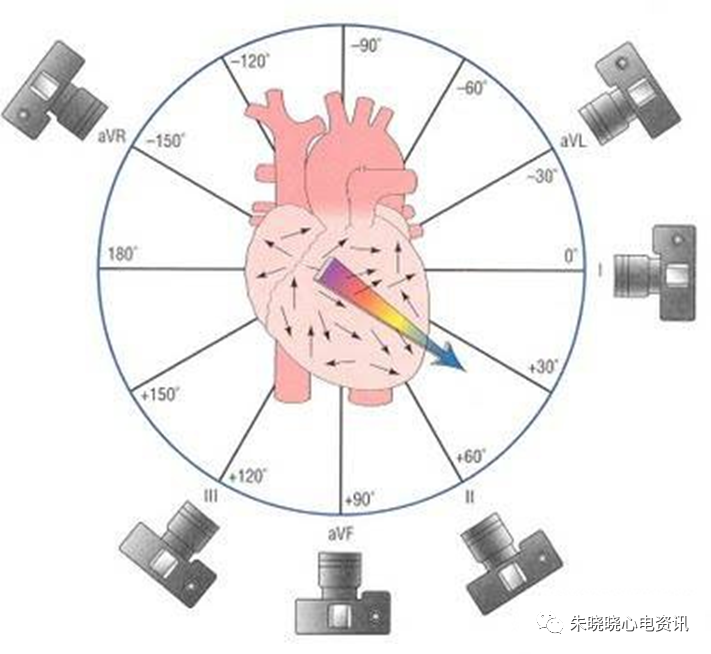 什么是同步心电图心电轴的测量方法，你掌握了几种？_https://www.jmylbn.com_新闻资讯_第5张