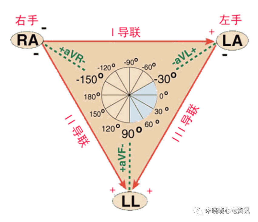 什么是同步心电图心电轴的测量方法，你掌握了几种？_https://www.jmylbn.com_新闻资讯_第7张