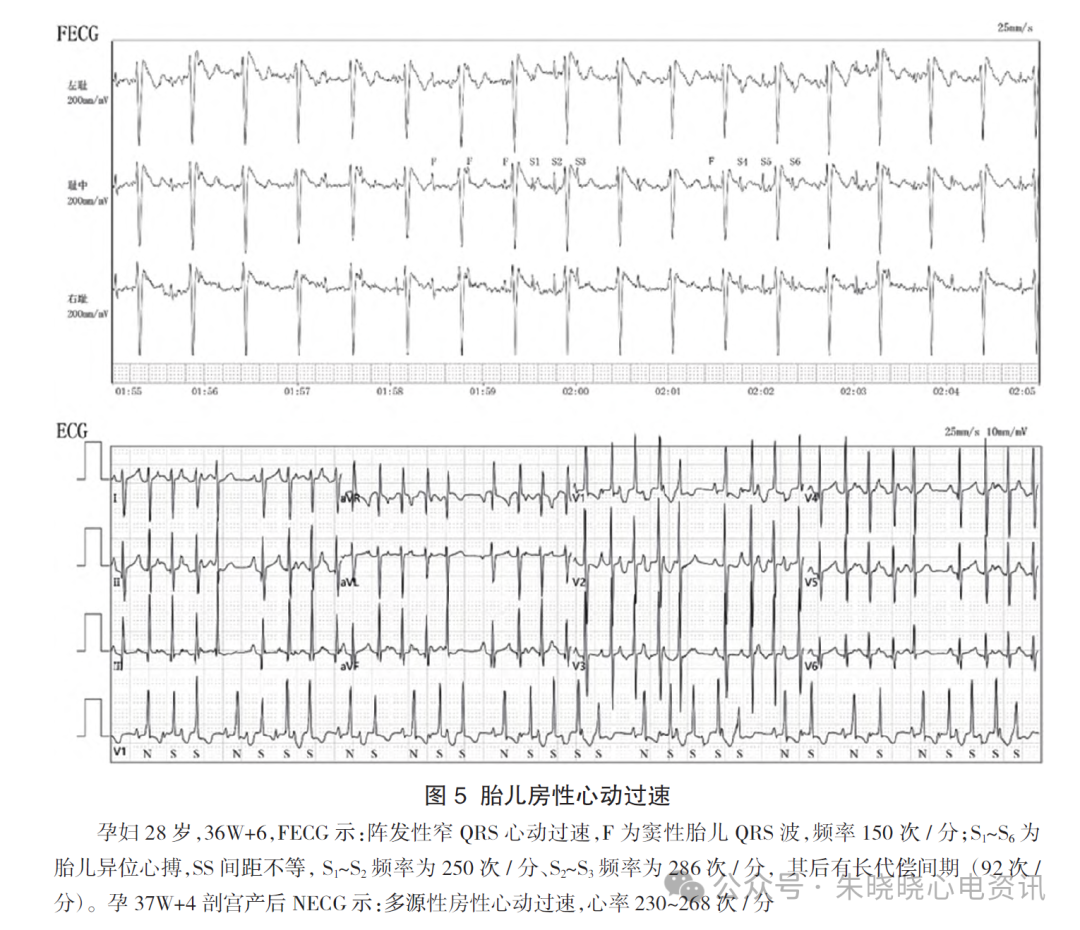胎儿心电图是什么意思胎儿心电图精要_https://www.jmylbn.com_新闻资讯_第8张