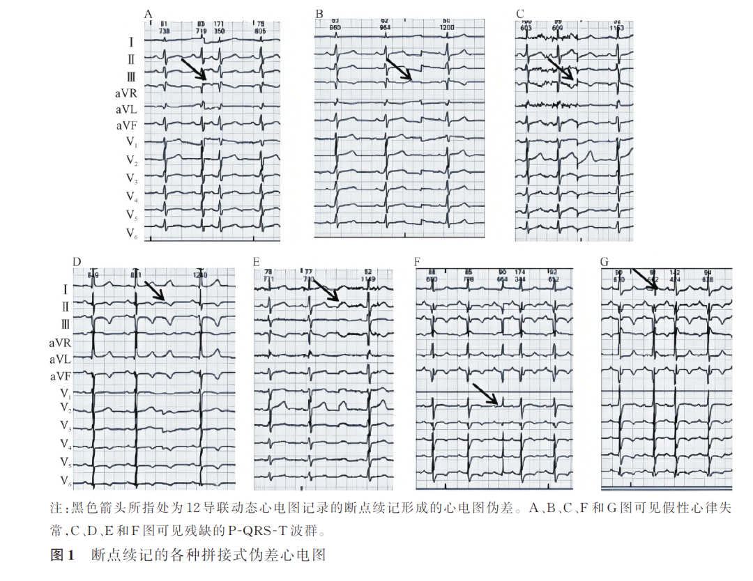 动态心电图怎么更换电池断点续记的动态心电图伪差特点及原因探讨_https://www.jmylbn.com_新闻资讯_第3张