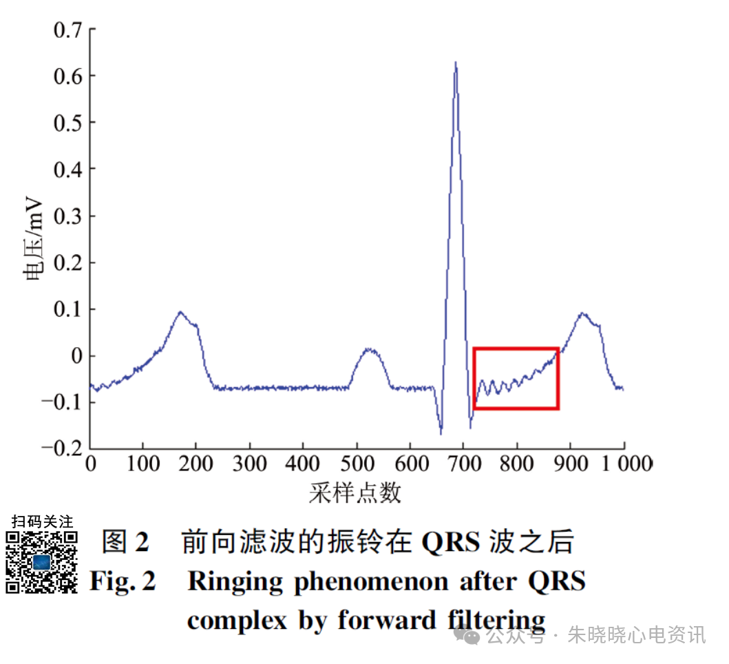 心电图滤波怎么选择振铃现象对心电图分析和诊断的影响_https://www.jmylbn.com_新闻资讯_第4张
