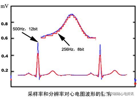 心电图滤波怎么选择【心电国际指南2009】第一部分：心电图及技术（2）_https://www.jmylbn.com_新闻资讯_第14张