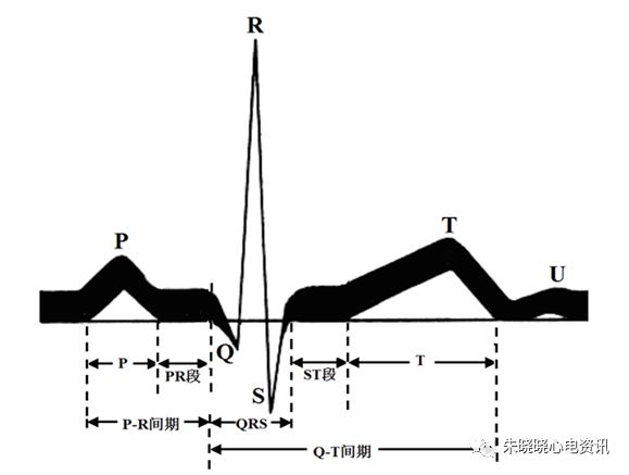 心电图滤波怎么选择【心电国际指南2009】第一部分：心电图及技术（2）_https://www.jmylbn.com_新闻资讯_第12张