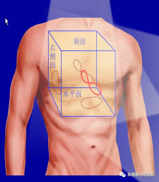 心电图滤波怎么选择【心电国际指南2009】第一部分：心电图及技术（2）_https://www.jmylbn.com_新闻资讯_第10张