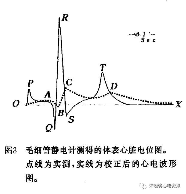 心电监护f n是什么【心电历史】六、方祖祥教授：心电图技术发展的历史回顾_https://www.jmylbn.com_新闻资讯_第4张