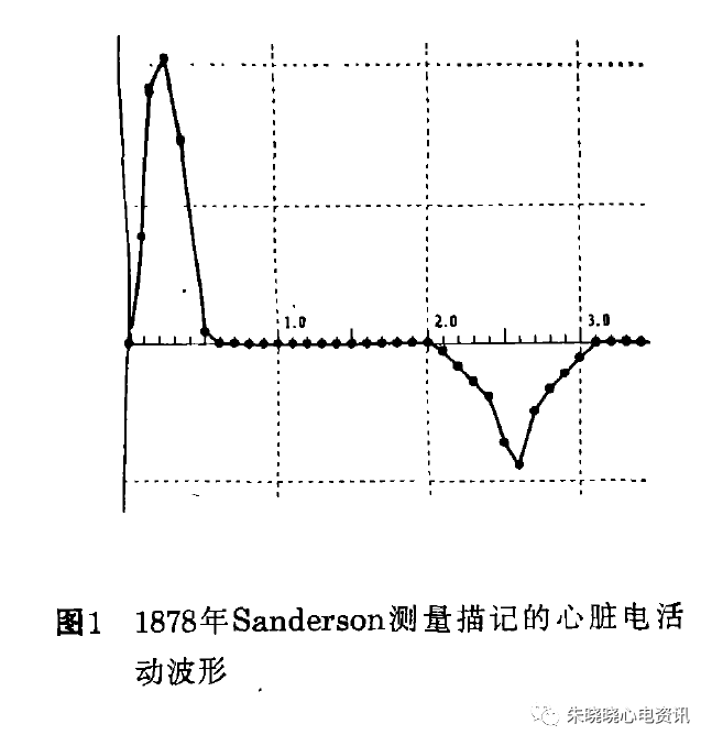 心电监护f n是什么【心电历史】六、方祖祥教授：心电图技术发展的历史回顾_https://www.jmylbn.com_新闻资讯_第2张