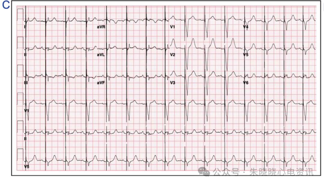 为什么双极不起博锁骨下挤压综合征_https://www.jmylbn.com_新闻资讯_第6张