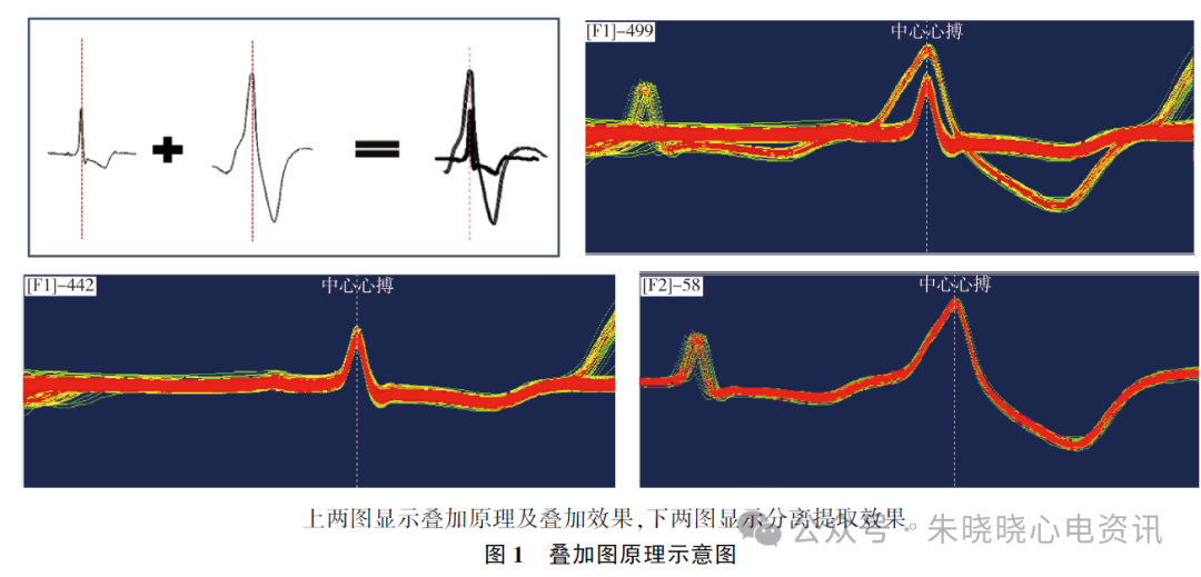 动态心电图怎么分析应用叠加图快速分析动态心电图_https://www.jmylbn.com_新闻资讯_第3张