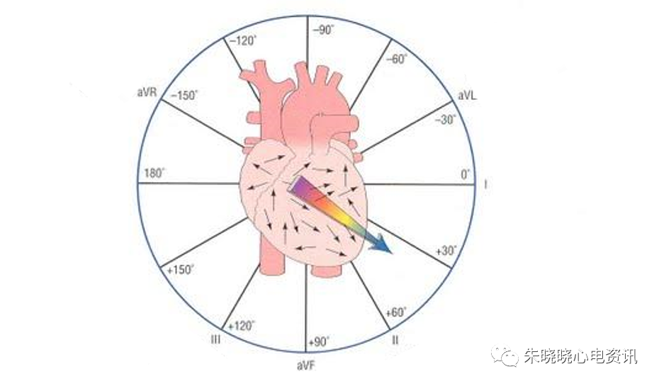 什么是同步心电图心电轴的测量方法，你掌握了几种？_https://www.jmylbn.com_新闻资讯_第4张