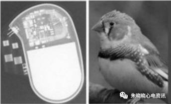百多力起搏器怎么样通过胸片识别起搏器的简易三步法_https://www.jmylbn.com_新闻资讯_第8张