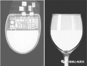百多力起搏器怎么样通过胸片识别起搏器的简易三步法_https://www.jmylbn.com_新闻资讯_第9张