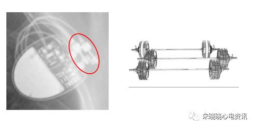 百多力起搏器怎么样通过胸片识别起搏器的简易三步法_https://www.jmylbn.com_新闻资讯_第16张